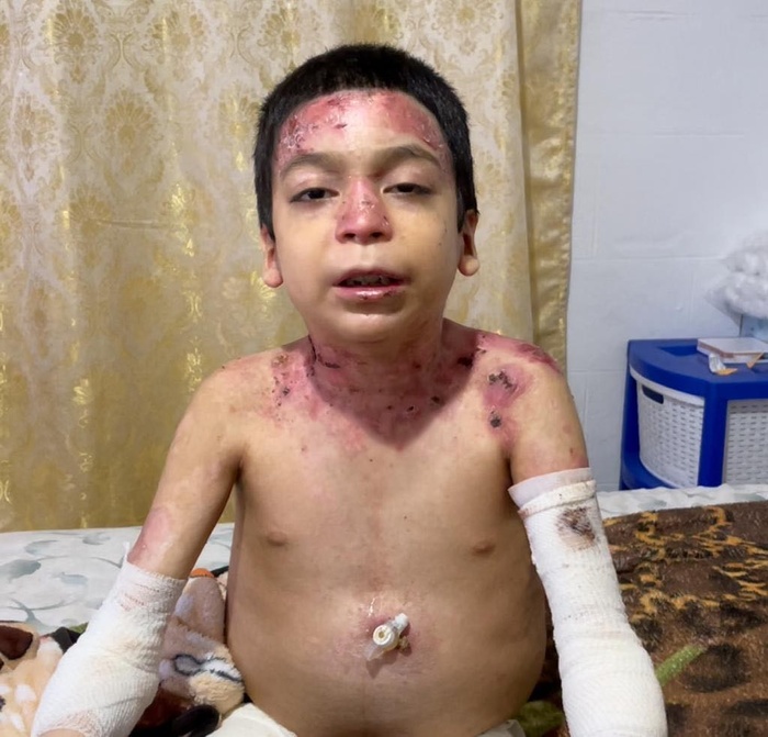 Por favor, doe para aliviar a dor intensa de Jesus e ajudar a salvar sua vida!